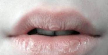 Белые губы Почему губы бледные и сухие